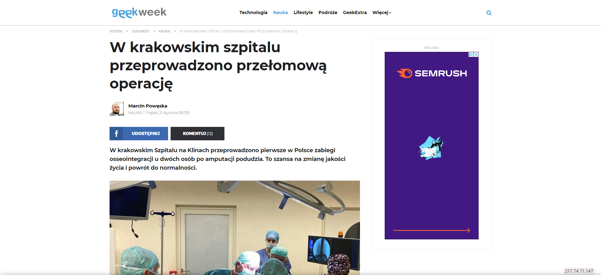 w krakowskim szpitalu przeprowadzono przelomowa operacje